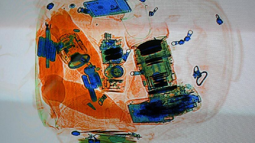 Objetos metálicos não ficam translúcidos no raio-x. Imagem: IDuke/Wikimedia Commons