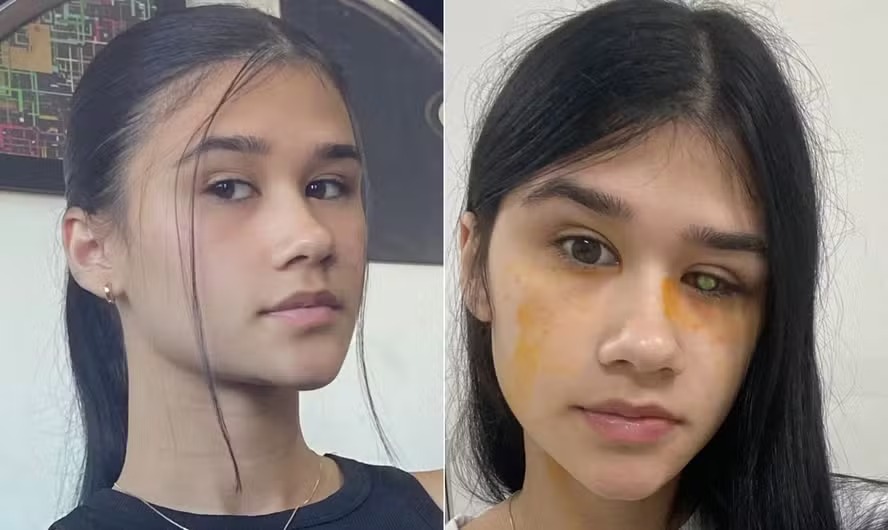 Lara Brandão antes e depois