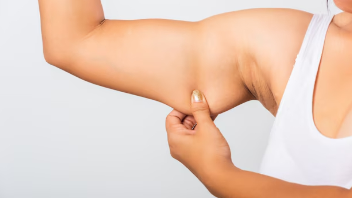 Especialistas revelam melhor treino para combater gordura atrás dos braços (Foto: Freepik)