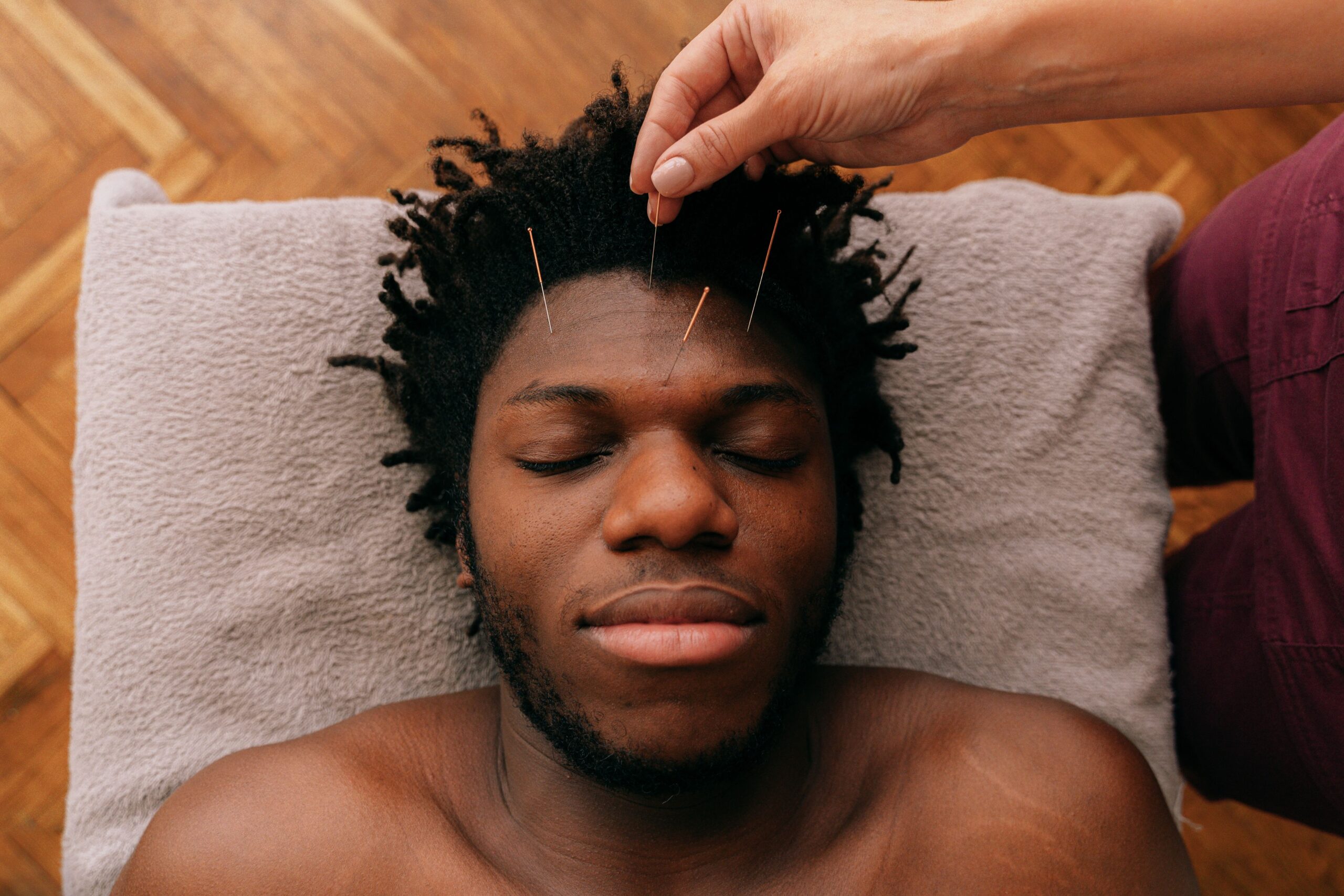 Estudos indicam que a acupuntura favorece a liberação de substâncias naturais ligadas ao alívio da dor e ao relaxamento (Foto: Pexels)