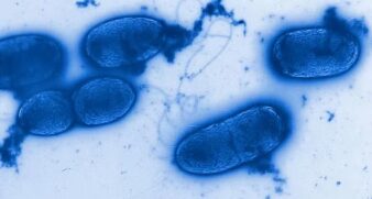 Imagem ampliada de Bactéria Pseudomonas aeruginosa