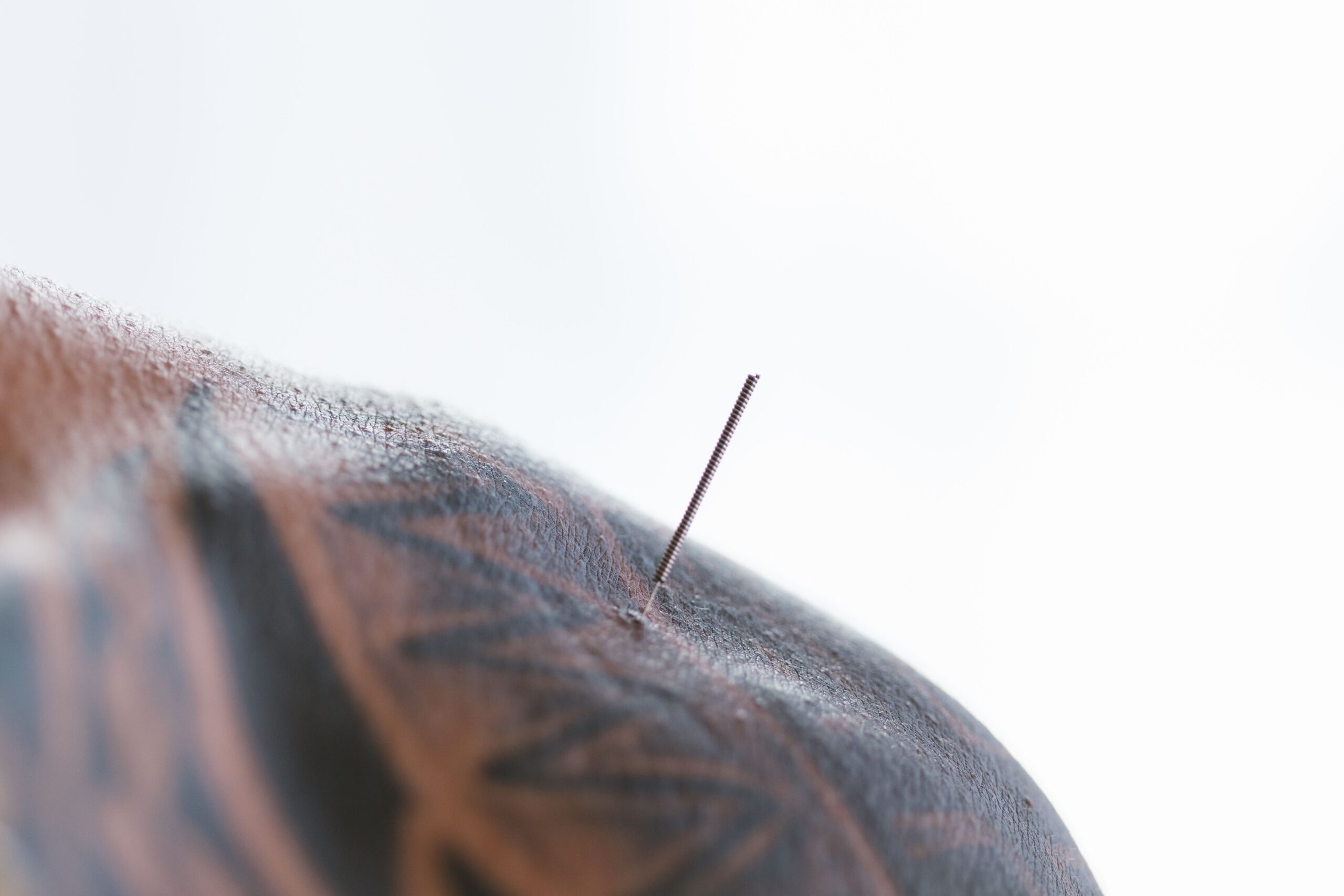 A ciência explica como a acupuntura influencia o cérebro e o corpo para ajudar no controle da dor de forma complementar (Foto: Pexels)