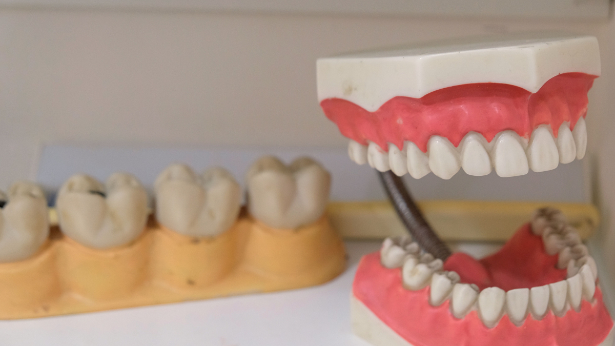 O último dente a nascer guarda curiosidades evolutivas e nem sempre exige remoção imediata (Foto: Pexels)