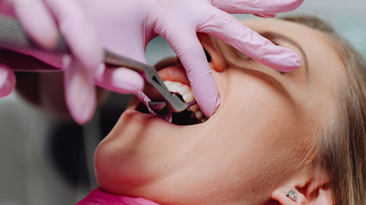 Dor, inflamação e falta de espaço estão entre os sinais que podem indicar a necessidade de cirurgia (Foto: Pexels)