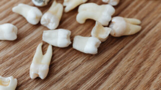 Nem todo terceiro molar representa um risco; muitos permanecem saudáveis e funcionais durante toda a vida (Foto: Pexels)