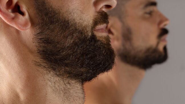 Barba rala cuidados (Foto_ Magnific) (1)