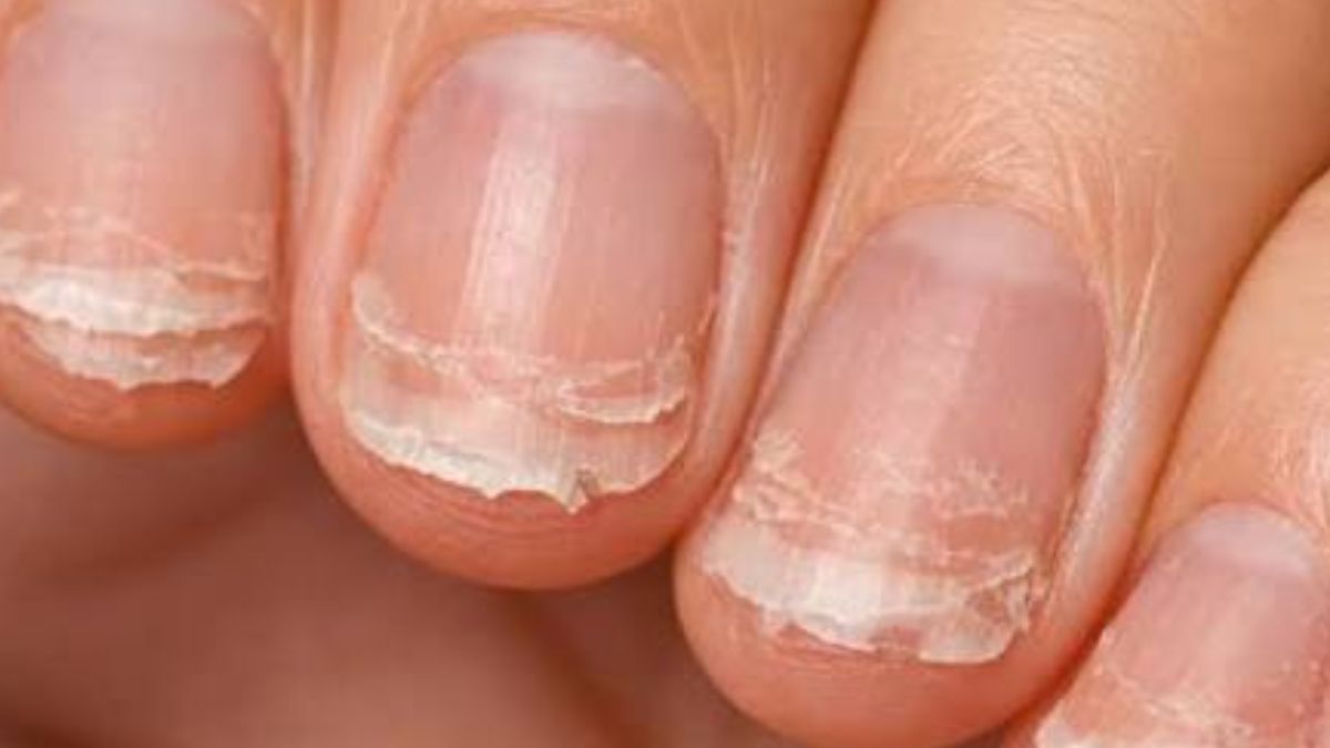 unhas