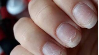 unhas