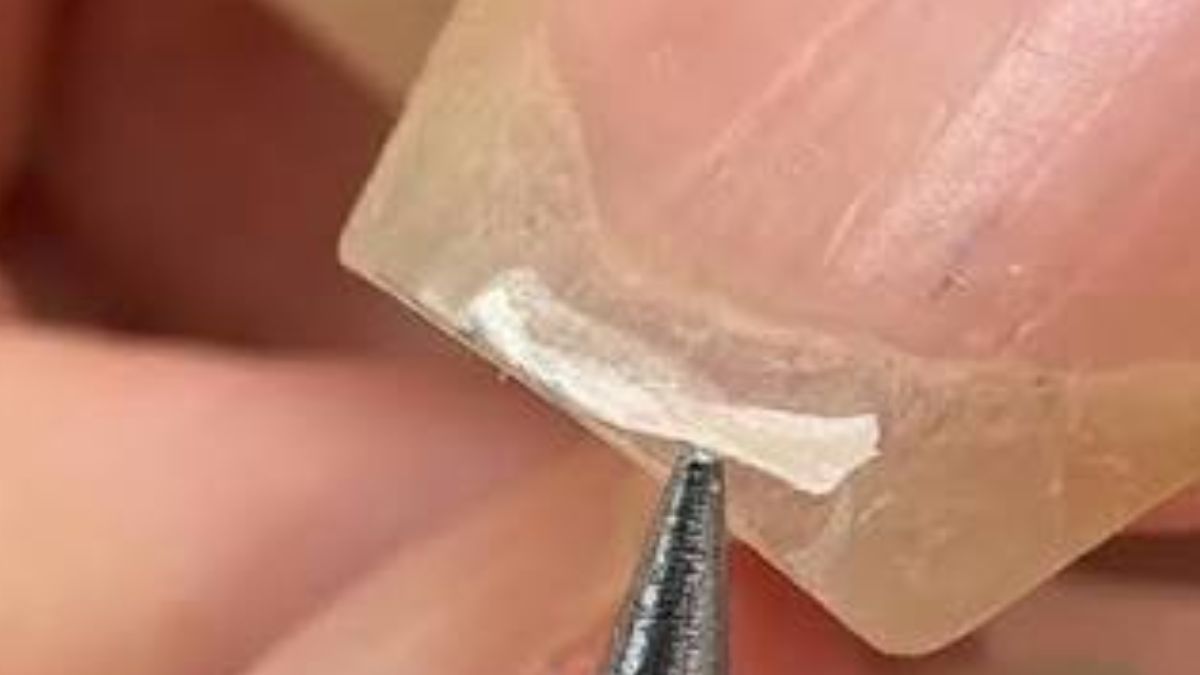 unhas
