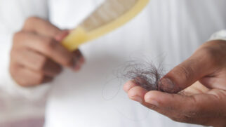 Alimentos ricos em vitaminas, proteínas e minerais podem contribuir para reduzir a queda de cabelo e fortalecer os fios naturalmente (Foto: Towfiqu barbhuiya/ Pexels)