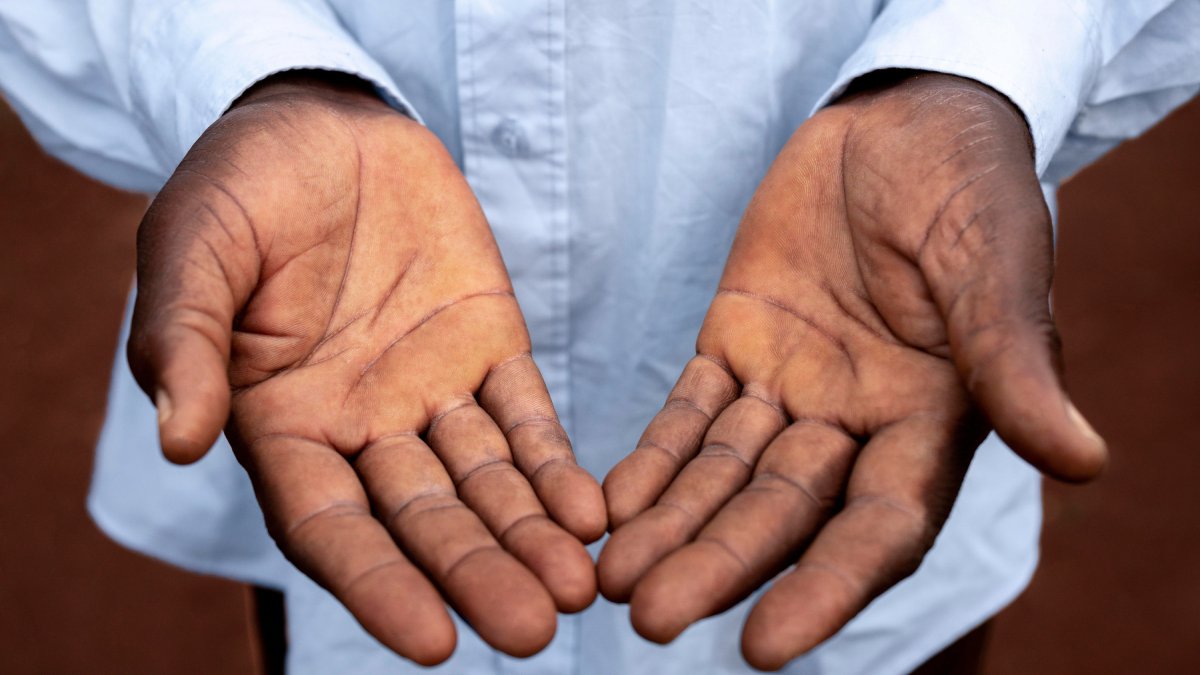 Cada um dos dedos desempenha funções específicas que ajudam a tornar a mão humana mais eficiente (Foto: Reprodução/Freepik)