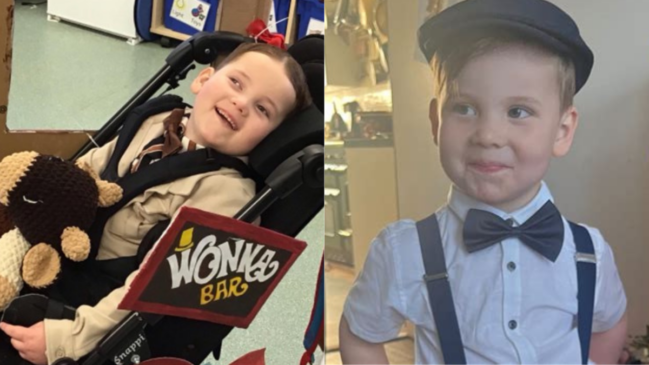 Harrison antes e depois das complicações de saúde que mudaram sua rotina aos 3 anos (Foto: Reprodução/Luton Today)