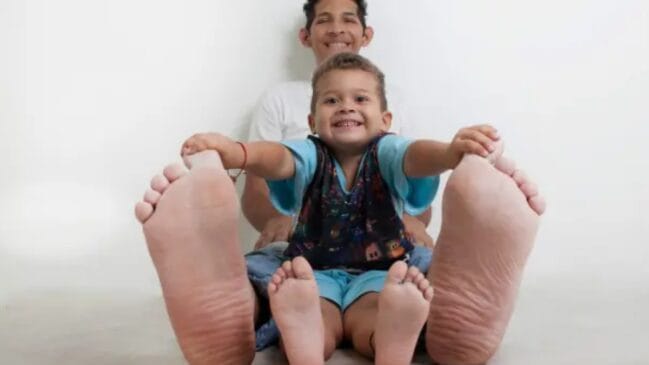 Homem do maior pé do mundo