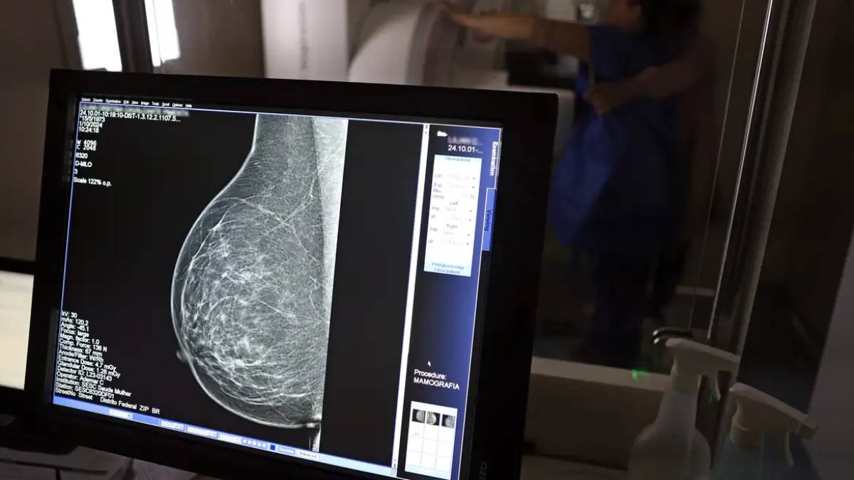 O exame permite armazenar as imagens digitalmente, facilitando comparações durante o acompanhamento médico.