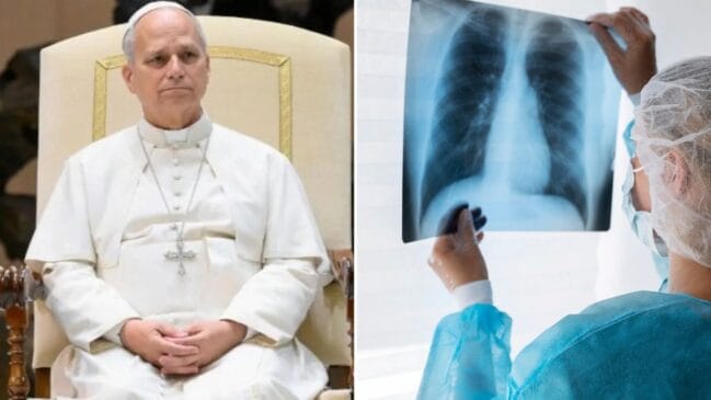 nódulo pulmonar