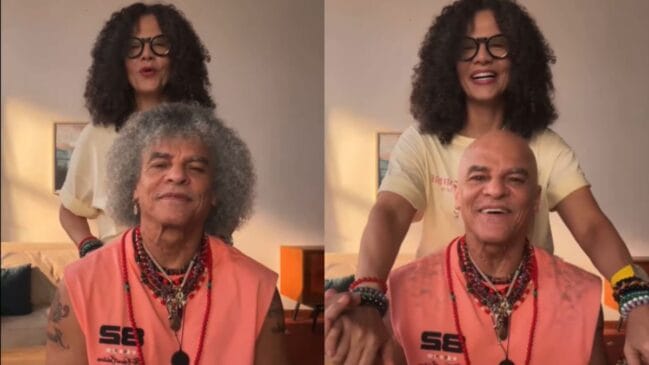 Montagem comparativa "antes e depois" mostrando o ex-futebolista colombiano Carlos Valderrama acompanhado por uma mulher de cabelo encaracolado e óculos. À esquerda, Valderrama aparece com o seu característico cabelo volumoso e de tom acinzentado; à direita, ele surge completamente careca e a sorrir, enquanto a mulher atrás dele segura as suas mãos