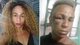 Fernanda Frazão, artista trans agredida em SP