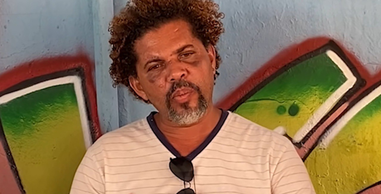 Givaldo Alves, agredido por personal trainer