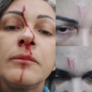 Ela conta que última quinta-feira, foi agredida verbalmente e fisicamente por uma mãe de aluno, na presença da Diretora da escola, do próprio filho (criança de 8 anos)