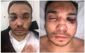 Isaac Lopes Alves conta que sofreu fraturas no rosto após ser agredido por seis seguranças da festa