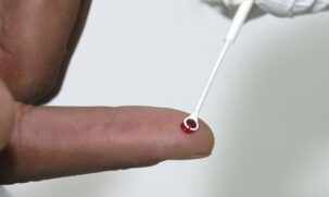 Visando a proteção da população no carnaval, a campanha disponibilizará autotestes de HIV para passageiros que desejarem realizá-lo e orientações sobre o exame ofertado