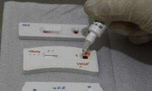 Estações da CPTM recebem serviços de testagem rápida para HIV, Sífilis, Hepatites B e C