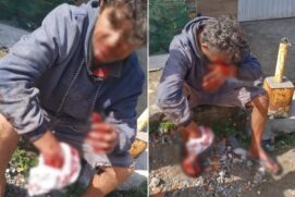 A vítima estava hospedada na casa do dono do animal, foi resgatada e passa bem