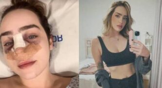 Nutricionista foi agredida e teve o nariz quebrado após discussão em São Caetano do Sul