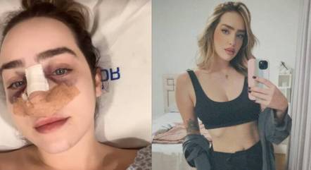 Nutricionista foi agredida e teve o nariz quebrado após discussão em São Caetano do Sul
