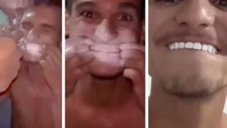 Em suas redes sociais, um jovem gravou um método que supostamente clareia os dentes; o método ganhou notoriedade por usar tinta branca de parede mas segundo dentista o procedimento é perigoso