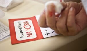 A comissão será coordenada pelo Departamento de HIV/Aids, Tuberculose, Hepatites Virais e Infecções Sexualmente Transmissíveis e composta por 35 membros com respectivos suplentes