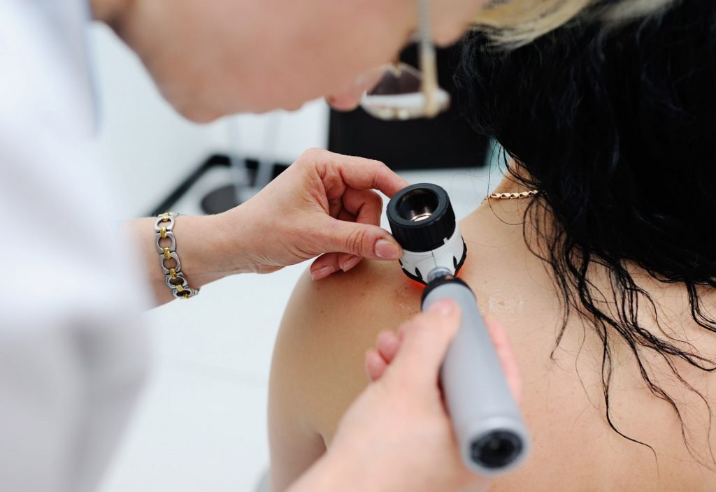 Em caso de aparecimento de pintas no corpo, é muito importante procurar avaliação médica