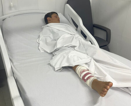 Theo está sob cuidados médicos em Boituva