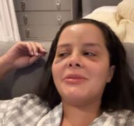 Maraisa com hematomas no rosto