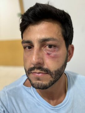 O ex-vereador Luís Eduardo Ribeiro enviou fotos após acusar Lê Braga de agressão