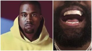 Kanye West coloca uma nova prótese dentária avaliada em mais de R$ 4 milhões