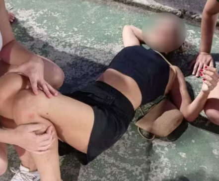 Como resultado do acidente, a professora sofreu uma fratura no fêmur esquerdo