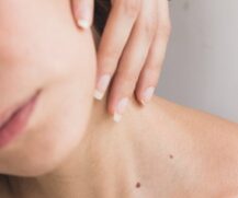 Caso a pele não seja bem cuidada e hidratada, uma série de doenças podem aparecer, pois ela é a barreira do corpo com o meio externo.