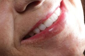 Um sorriso bonito e saudável ajuda a elevar a autoestima e, além disso, traz benefícios para a saúde