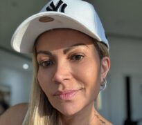 Solange passa por cirurgia