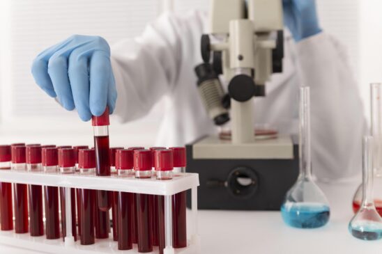 Descubra quais tipos de sangue são compatíveis em uma transfusão