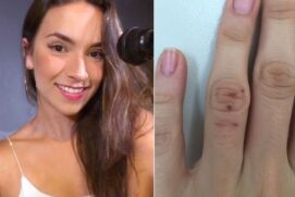 Cantora é assaltada no litoral de SP