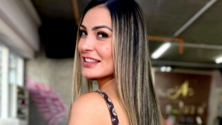 a modelo publicou em suas redes sociais o resultado de sua nova cirurgia