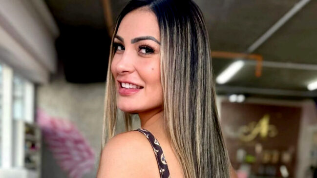 a modelo publicou em suas redes sociais o resultado de sua nova cirurgia