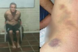 Paciente Jarmo Celestino de Santana foi torturado e morto em clínica de reabilitação em Cotia