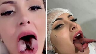 Andressa Urach pagou R$ 1.350 mil no procedimento estético que dividiu sua língua no meio