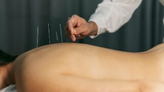 A acupuntura é uma prática milenar desenvolvida na China que consiste na inserção de agulhas em lugares específicos do corpo