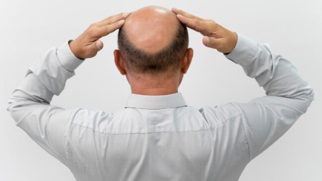 Uma coisa que assusta muitas pessoas com o passar dos anos é a queda de cabelo