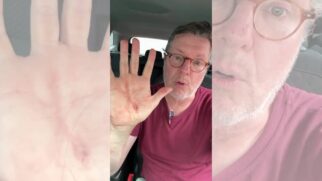 Jornalista sofreu um corte na mão durante a tentativa de assalto