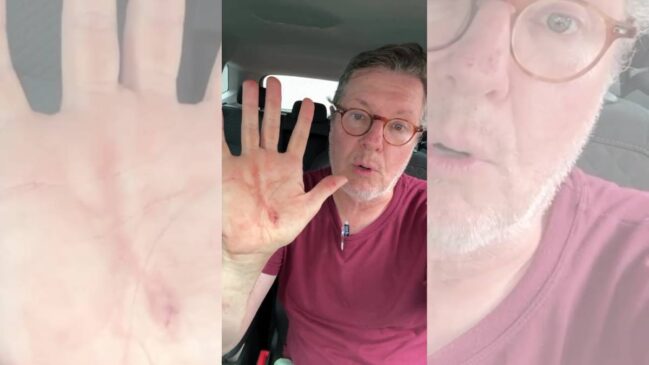 Jornalista sofreu um corte na mão durante a tentativa de assalto